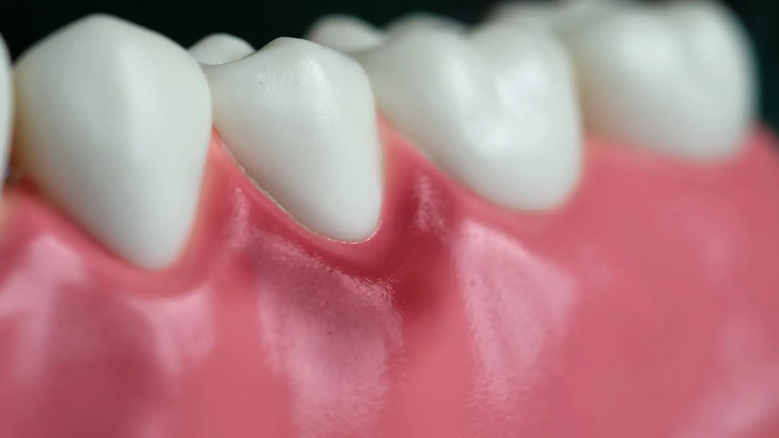 berita kesehatan gigi