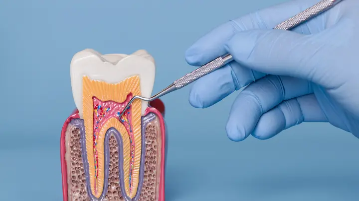 Keberhasilan Transplantasi Gigi & Kondisi Akar Gigi