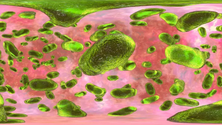 Membungkam Bakteri Penyakit Gusi: Peneliti Temukan "Rem Genetik" pada Porphyromonas gingivalis Pendahuluan Penyakit gusi kronis atau periodontitis selama ini menjadi tantangan besar dalam dunia medis karena sifat bakterinya yang sangat adaptif. Namun, sebuah terobosan dalam Teknologi Kedokteran Gigi baru-baru ini memberikan harapan baru. Para peneliti menemukan adanya mekanisme "rem genetik" pada bakteri Porphyromonas gingivalis, biang keladi utama kerusakan jaringan pendukung gigi. Penemuan ini membuka peluang untuk "membungkam" bakteri jahat tanpa harus membunuh seluruh ekosistem bakteri baik di dalam mulut. Bagaimana "Rem Genetik" Ini Bekerja? Bakteri P. gingivalis memiliki kemampuan untuk merusak Kesehatan Gusi dengan melepaskan enzim yang menghancurkan jaringan ikat dan tulang. Peneliti menemukan bahwa bakteri ini memiliki urutan genetik tertentu yang bertindak sebagai pengendali aktivitasnya. Dengan memanipulasi "rem" ini, peneliti dapat: Menonaktifkan Virulensi: Membuat bakteri tetap ada di mulut namun tidak lagi bersifat merusak atau menyebabkan peradangan. Alternatif Antibiotik: Mengurangi ketergantungan pada antibiotik spektrum luas yang sering kali menyebabkan resistensi bakteri di masa depan. Presisi Tinggi: Hanya menargetkan gen spesifik pada bakteri penyebab penyakit gusi tanpa mengganggu bakteri komensal yang bermanfaat. Masa Depan Perawatan Gusi yang Lebih Personal Inovasi ini menandai pergeseran besar dalam Teknologi Kedokteran Gigi, dari metode mekanis seperti pembersihan karang gigi menuju terapi biologis yang lebih cerdas. Dengan mengontrol aktivitas genetik bakteri langsung di sumbernya, risiko kehilangan gigi akibat periodontitis dapat ditekan secara drastis. Penemuan ini juga memberikan harapan bagi pasien dengan kondisi sistemik yang dipicu oleh infeksi gusi, seperti diabetes dan penyakit jantung. Kesimpulan Membungkam bakteri penyebab penyakit gusi melalui pendekatan genetik adalah langkah revolusioner dalam menjaga Kesehatan Gusi masyarakat. Seiring dengan perkembangan teknologi ini, perawatan gigi di masa depan akan menjadi lebih minim invasif, lebih tepat sasaran, dan lebih efektif dalam mempertahankan kesehatan mulut secara jangka panjang.