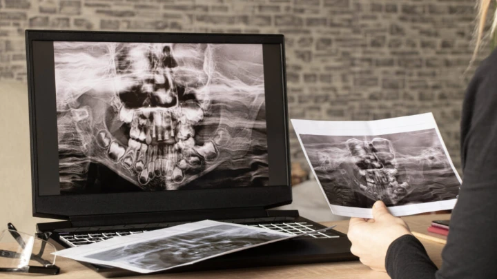 Bahaya Deepfake Rontgen Gigi