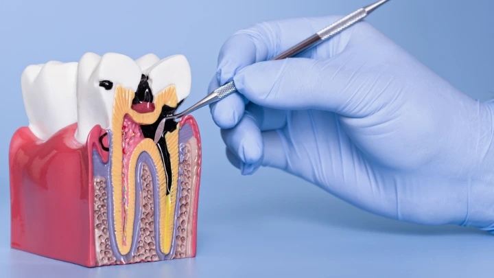 Pulpa Gigi untuk Sembuhkan Luka Cabut