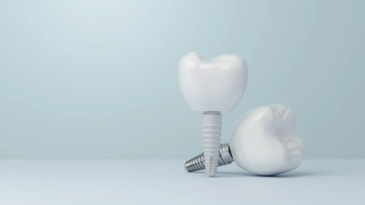 Implan Zirkonia vs Titanium: Studi Imun