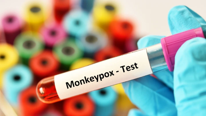 Lesi Mulut Tanda Awal Mpox Monkeypox