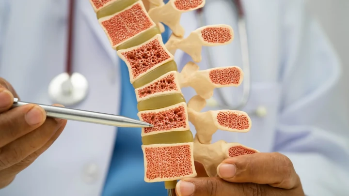 Periodontitis Perburuk Kerusakan Tulang via Gut Microbiota