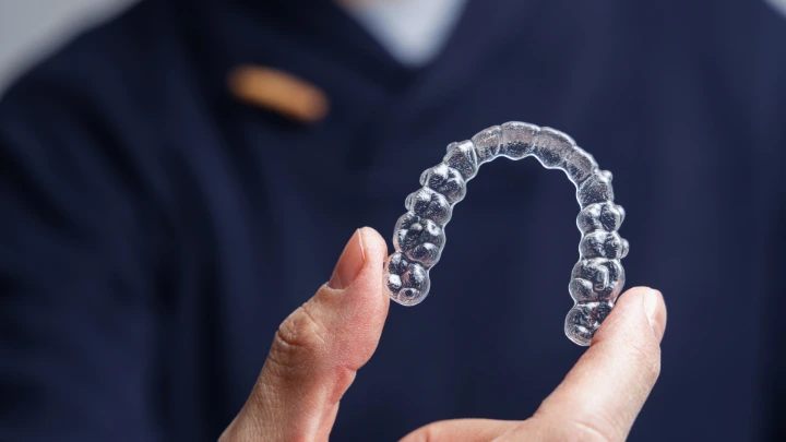 Potensi Mikroplastik dari Clear Aligner (Behel Bening)