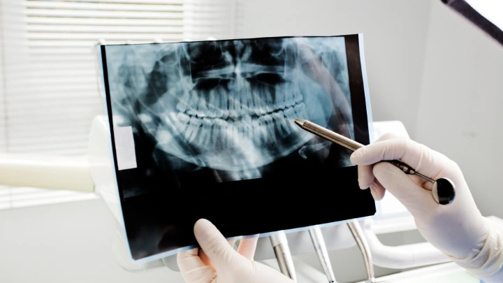 Kerangka Kerja Pelatihan Rontgen Gigi Tenaga Radiografi