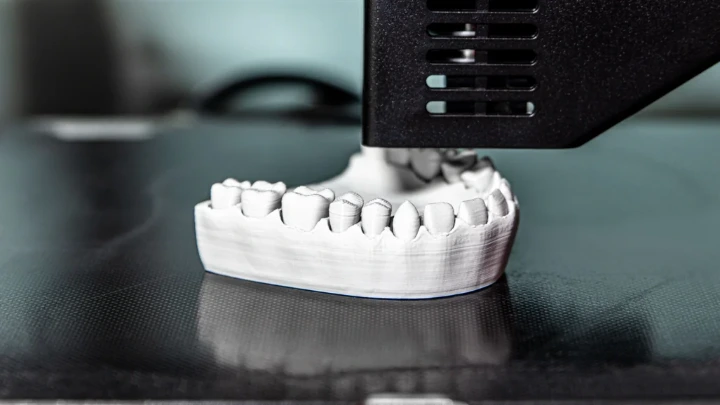 Perkembangan Cetak 3D untuk Restorasi Definitif Gigi