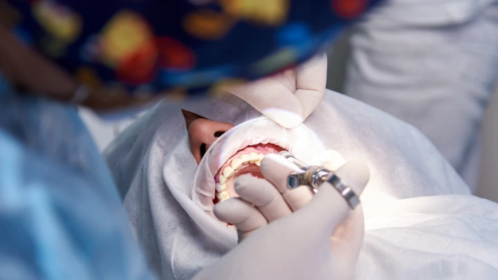 Simulasi Cetak 3D Pelatihan Bedah Mulut