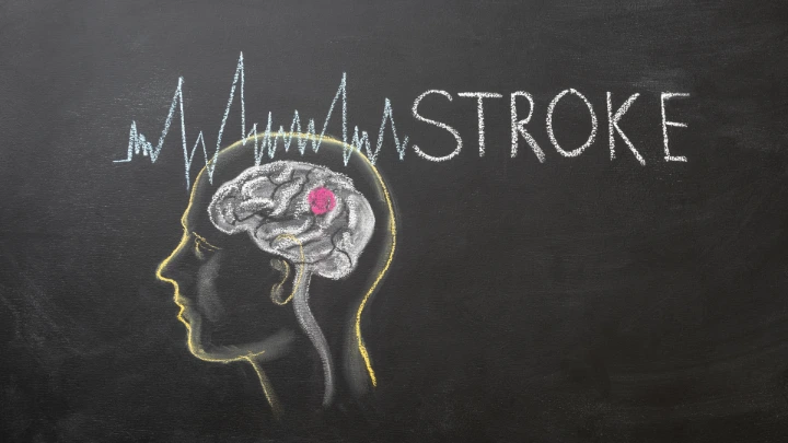 Program CEME: Perawatan Mulut Tekan Pneumonia Pasien Stroke